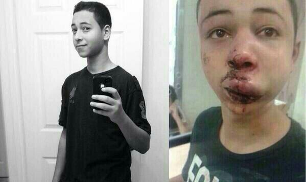 Tariq Khdeir, in a recent photo and after the beating recorded on video